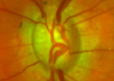 Inner Eye image 1