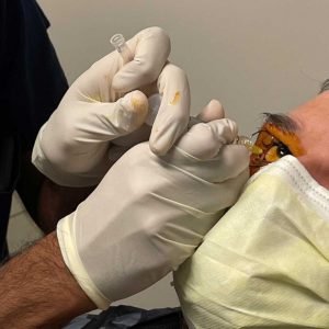 Intravitreal injection Sherman Tx
